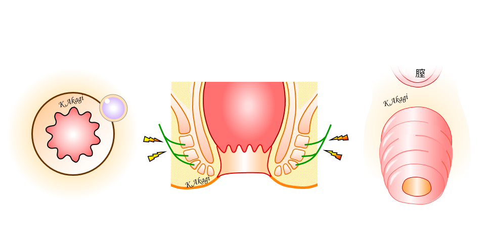 その他の直腸肛門疾患 よくわかる大腸肛門科